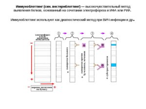 Иммунный блоттинг в диагностике ВИЧ (продолжение...)