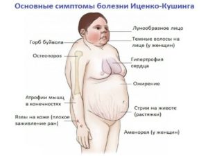 Симптомы болезни - нарушения гормонального фона