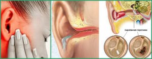 Повреждения внутреннего уха