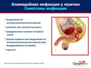 Зуд в мочеиспускательном канале