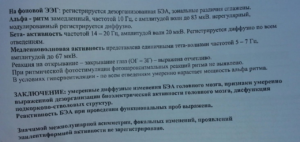 Изменение биоэлектрической активности общемозгового характера