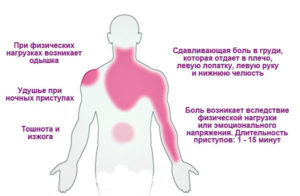 Симптомы болезни - боли в области сердца