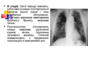 Легеневий малюнок збагачений