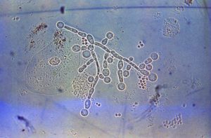 Mycoplasma genitalium и candida albicans