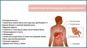 Симптомы болезни - боли во время аппендицита