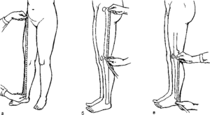 Как определить разницу в длине ног