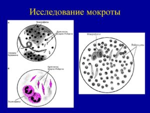 Цитология мокроты