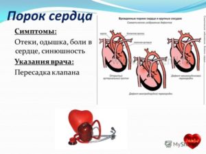 Симптомы болезни - боли в сердце у ребенка