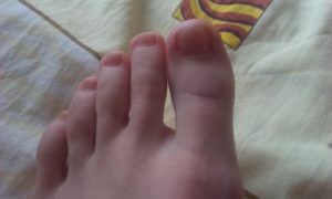 синеют пальцы ног