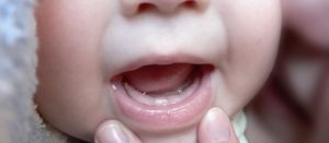 Прививки при прорезывании зубов (ребенку 6 мес.)