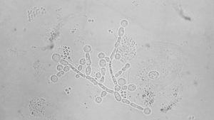 Mycoplasma genitalium и candida albicans