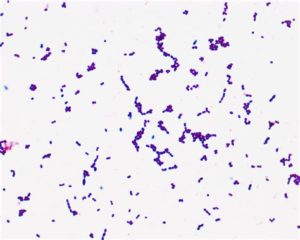 Enterococcus faecalis 10 в 5 ст. КОЕ/мл.