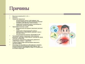 Причины возникновения гепатита С