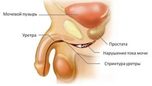 кровь из члена после полового акта,боли нет,уздечка цела,моча чистая