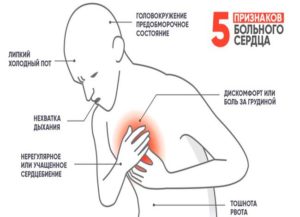 Симптомы болезни - боли в области сердца