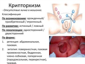 Полоса тёмногоцвета внизу члена и мошонки