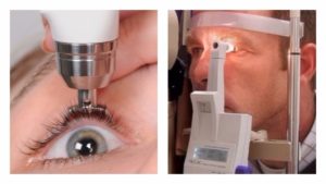 Исследование физических характеристик глаза (офтальмотонометрия)