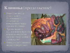 Эмболия и тромбоз мезентериальных сосудов