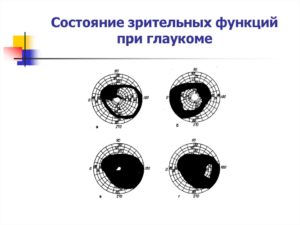 Оценка состояния зрительных функций глаза