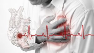 Сердечный приступ и остановка сердца у мужчин