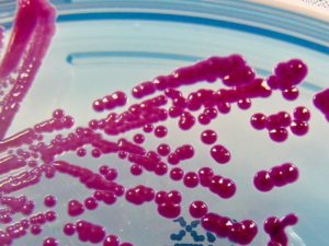 Serratia spp.