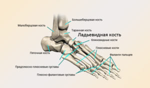 Болит ладьевидная кость стопы