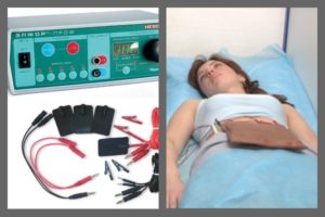 Электрофорез и магнитотерапия во время планирования беременности