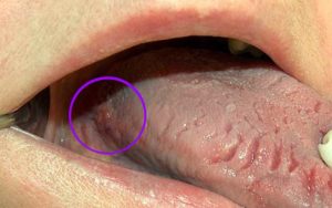 Симптомы болезни - боли в половых губах