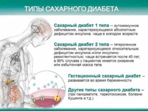 Сахарный диабет и инфекции