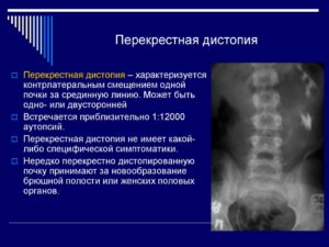 перекрестная дистопия