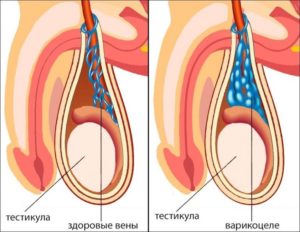 возможна ли пересадка яичка взрослому мужчине от его отца?