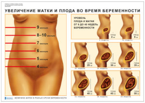 увеличение матки