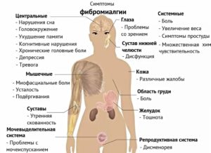 Симптомы болезней, Боли – М