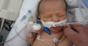 Ребенок второй раз за год болеет пневмонией