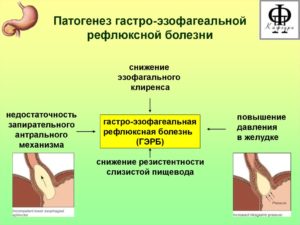 Восстановительное лечение при гастроэзофагальной рефлюксной болезни