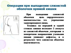 Как лечить выпадение прямой кишки у ребёнка 2-ух лет?