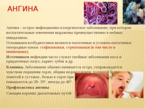 Ангины при инфекционных заболеваниях (продолжение...)