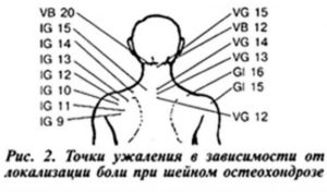 Примерные схемы лечения пчелоужалением