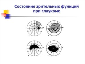 Оценка состояния зрительных функций глаза