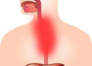Симптомы болезни - боли в пищеводе