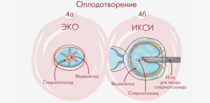 Не оплодотворяются яйцеклетки ЭКО+ИКСИ в чем причина?