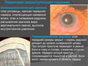 Первичная глаукома