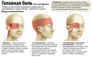 Головная боль: в  каких случаях должна насторожить?