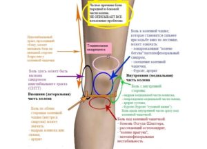 Симптомы болезни - боли в колене во время ходьбы