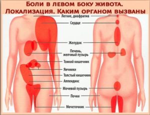 боль в левом боку в низу живота и в левом яичку