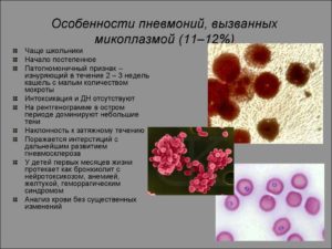 Микоплазма пневмонии