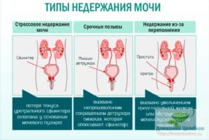 Недержание мочи, при беге,прыжках