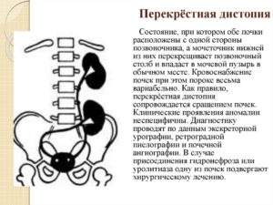 перекрестная дистопия