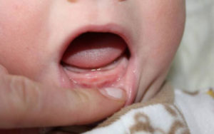 Прививки при прорезывании зубов (ребенку 6 мес.)