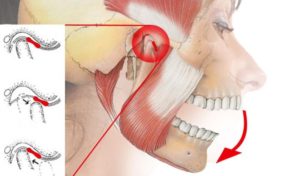 не могу полностью открыть рот и боль в челюсти